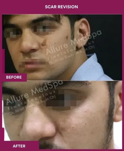 8 Scar Revision (4)_12_