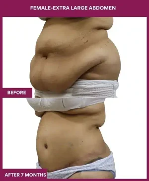 9 FEMALE-EXTRA LARGE ABDOMEN_ (3)