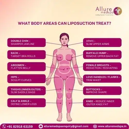 What Body Areas Can Liposuction Treat in Mumbai, India