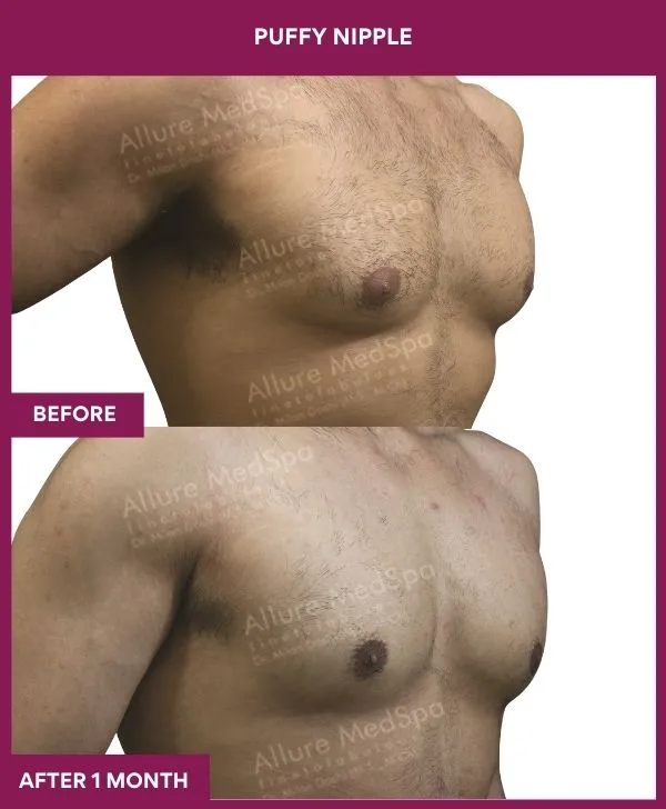 1 PUFFY NIPPLE_75_ (4)