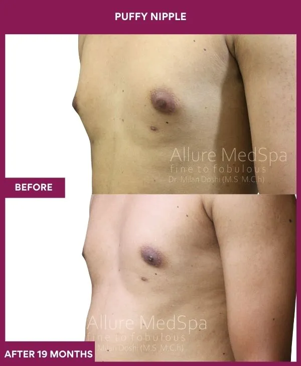 2 PUFFY NIPPLE (6)_66