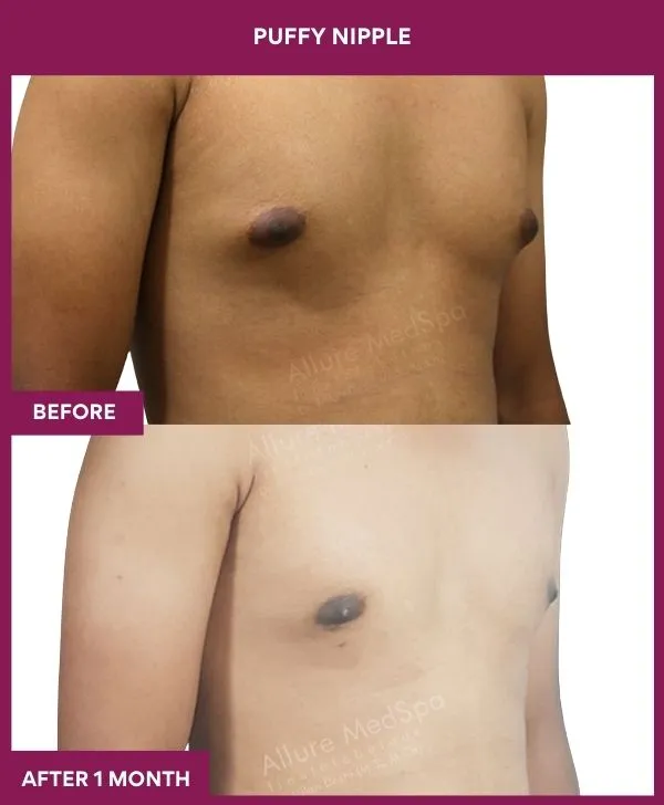 5 PUFFY NIPPLE_75_ (3)