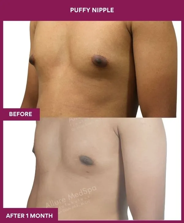 5 PUFFY NIPPLE_75_ (5)