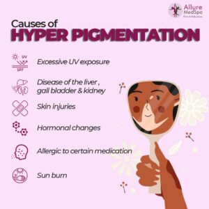 Know what causes hyperpigmentation: skin injuries, allergic, sun burn, hormonal changes
