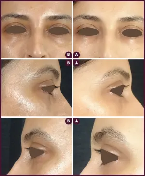 Allure_Sweta_Dark_circle_2021-1