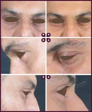 Allure_Sweta_Dark_circle_2021-2