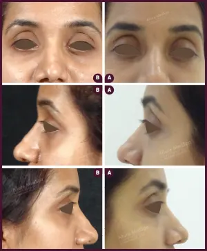 Allure_Sweta_Dark_circle_2021-4