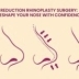 Reduction Rhinoplasty