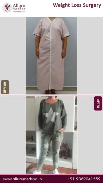 Weight-Loss-Surgery-Before-and-After-Photos-in-Mumbai-India