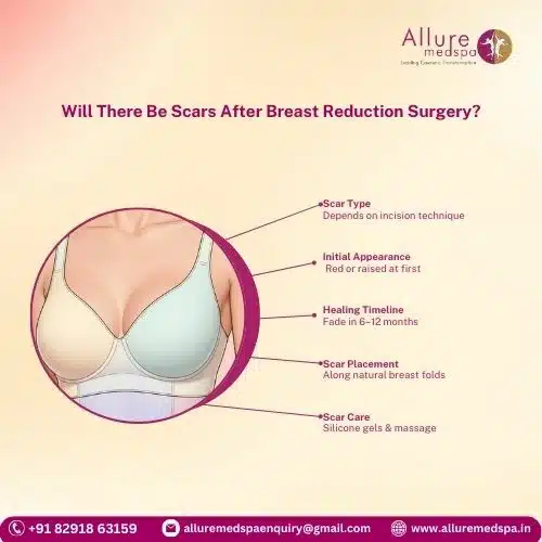 Will There Be Scars After Breast Reduction Surgery in Mumbai, India