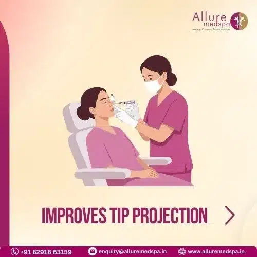 IMPROVES TIP PROJECTION