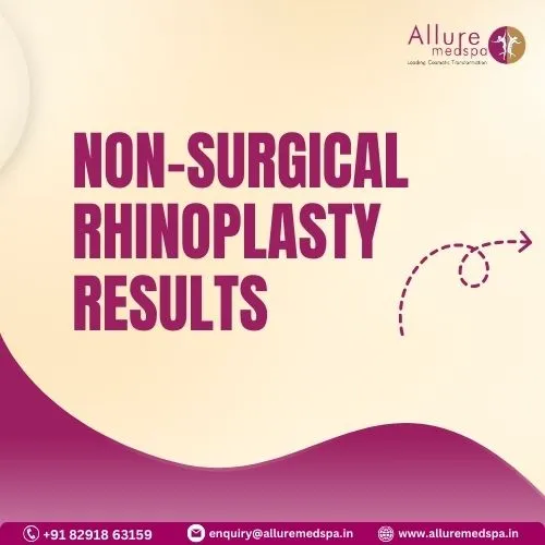 NON-SURGICAL RHINOPLASTY RESULTS