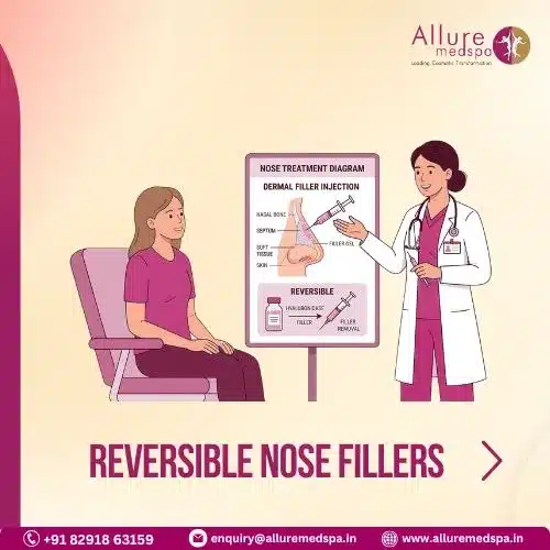 Reversible Nose Fillers