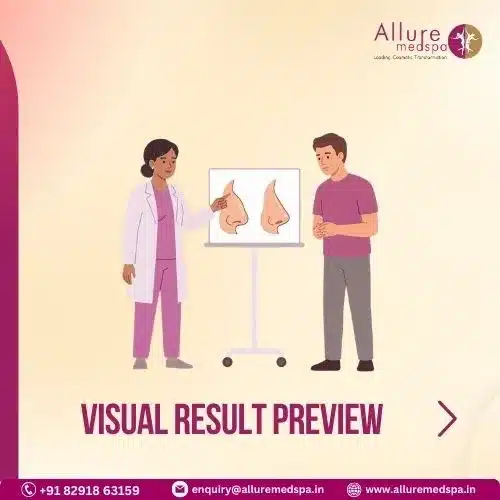 VISUAL RESULT PREVIEW